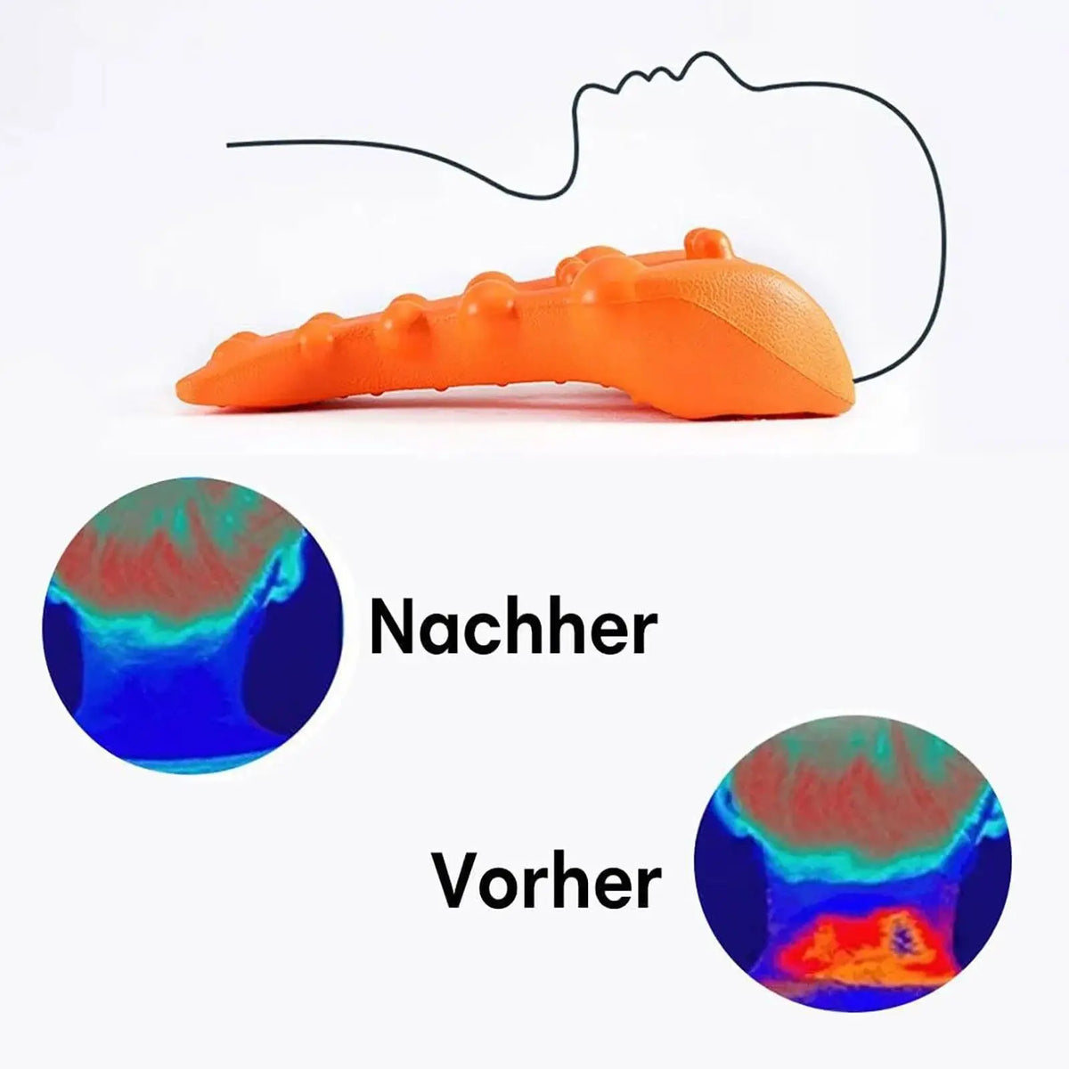 Cervical Neck Stretcher – Traction & Trigger Point Support Device