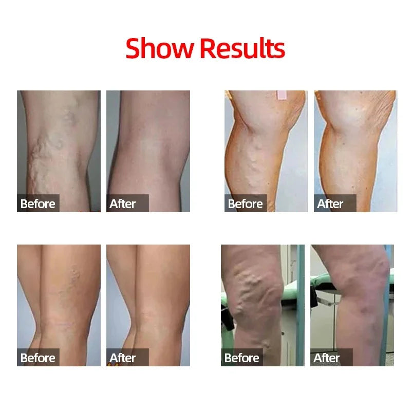 Running Compression Calf Sleeves – 20–30mmHg Leg Support for Men & Women