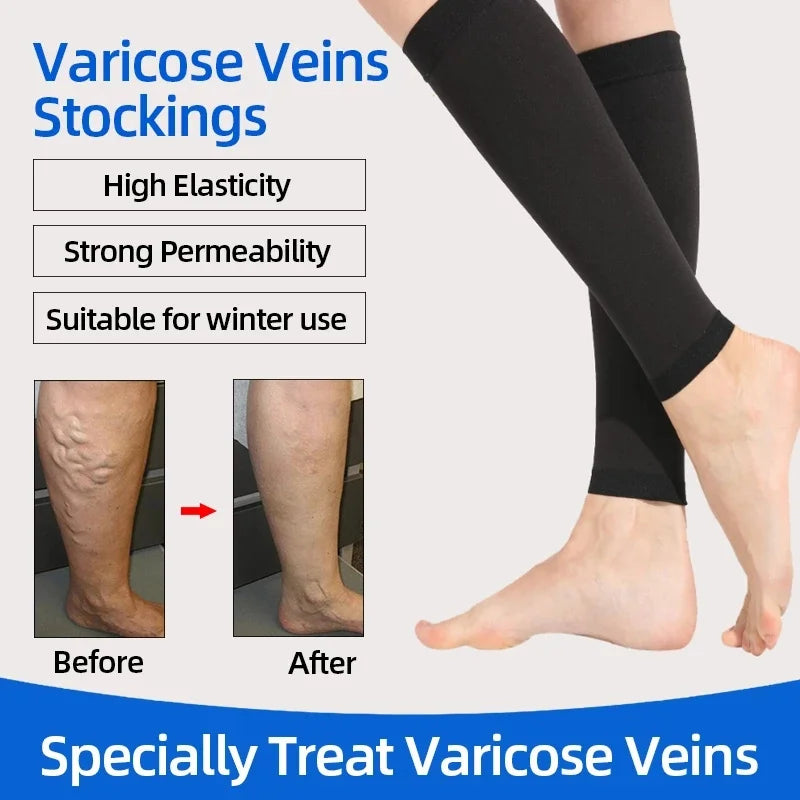 Running Compression Calf Sleeves – 20–30mmHg Leg Support for Men & Women